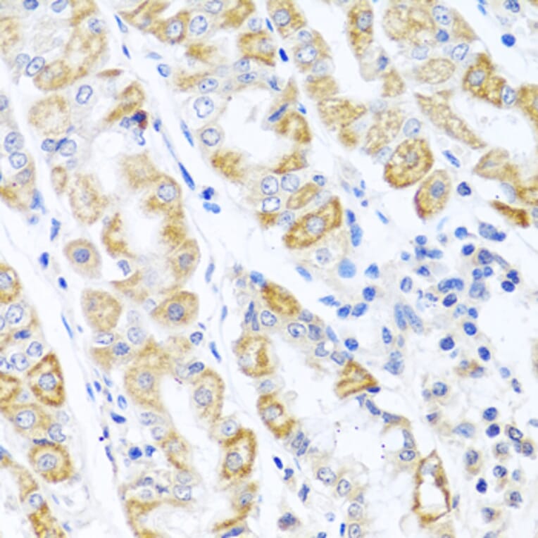 Immunohistochemistry - Anti-p18 INK4c / CDKN2C Antibody (A306880) - Antibodies.com