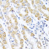 Immunohistochemistry - Anti-p18 INK4c / CDKN2C Antibody (A306880) - Antibodies.com