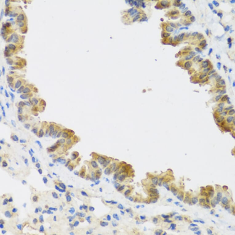 Immunohistochemistry - Anti-p18 INK4c / CDKN2C Antibody (A306880) - Antibodies.com