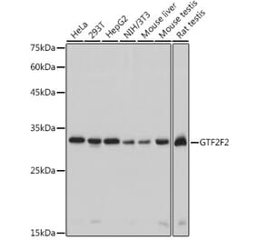 Western Blot - Anti-GTF2F2 Antibody [ARC2513] (A306881) - Antibodies.com