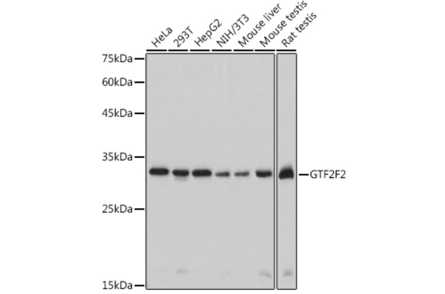Western Blot - Anti-GTF2F2 Antibody [ARC2513] (A306881) - Antibodies.com