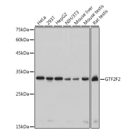 Western Blot - Anti-GTF2F2 Antibody [ARC2513] (A306881) - Antibodies.com