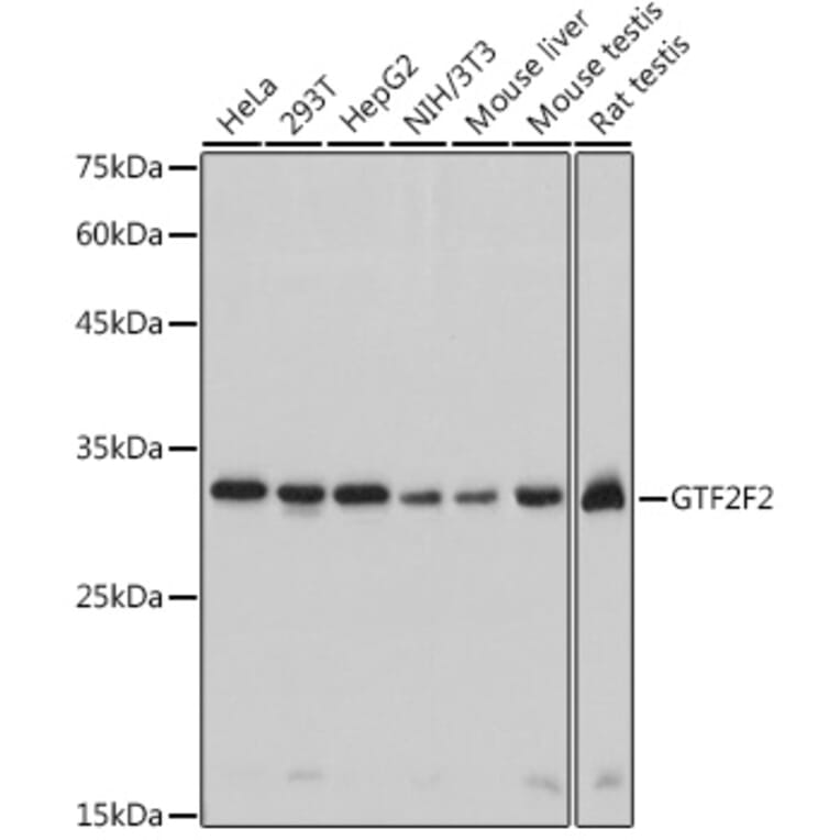 Western Blot - Anti-GTF2F2 Antibody [ARC2513] (A306881) - Antibodies.com