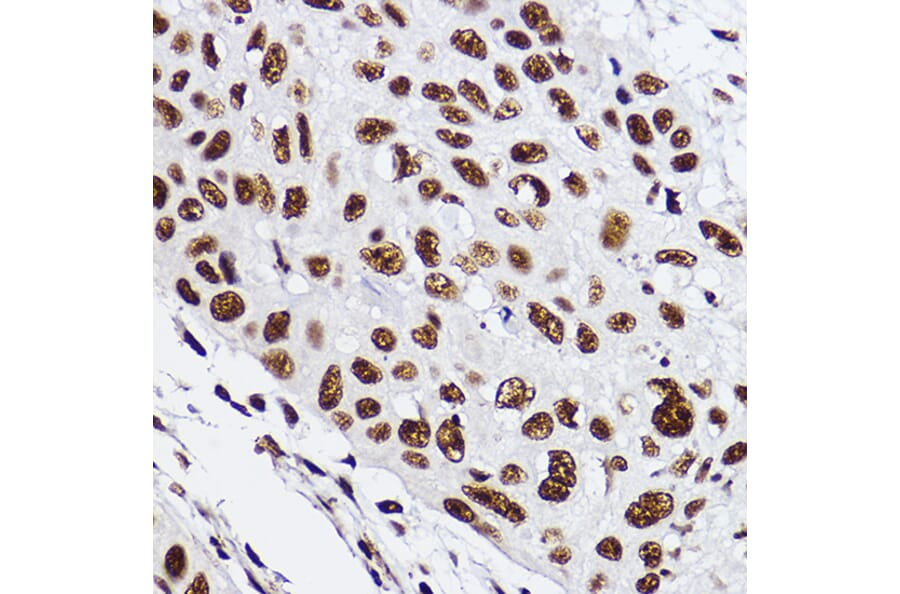 Immunohistochemistry - Anti-GTF2F2 Antibody [ARC2513] (A306881) - Antibodies.com