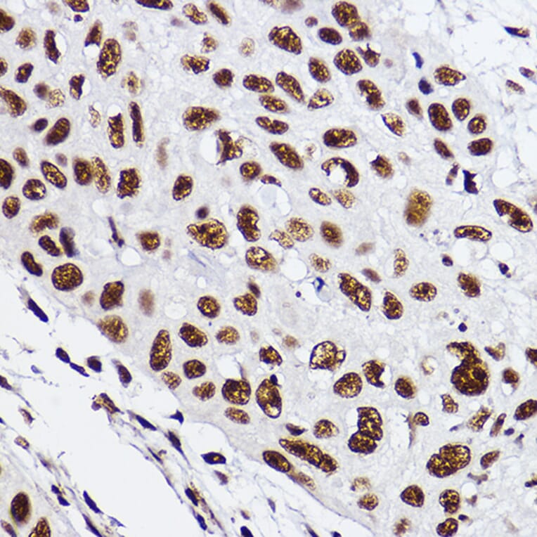 Immunohistochemistry - Anti-GTF2F2 Antibody [ARC2513] (A306881) - Antibodies.com