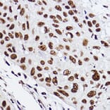 Immunohistochemistry - Anti-GTF2F2 Antibody [ARC2513] (A306881) - Antibodies.com