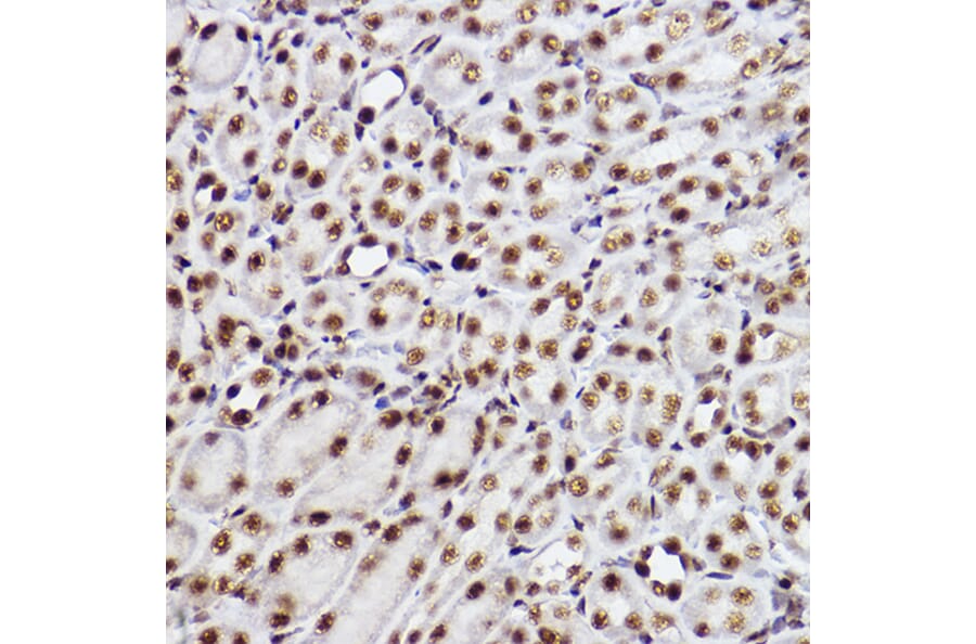 Immunohistochemistry - Anti-GTF2F2 Antibody [ARC2513] (A306881) - Antibodies.com