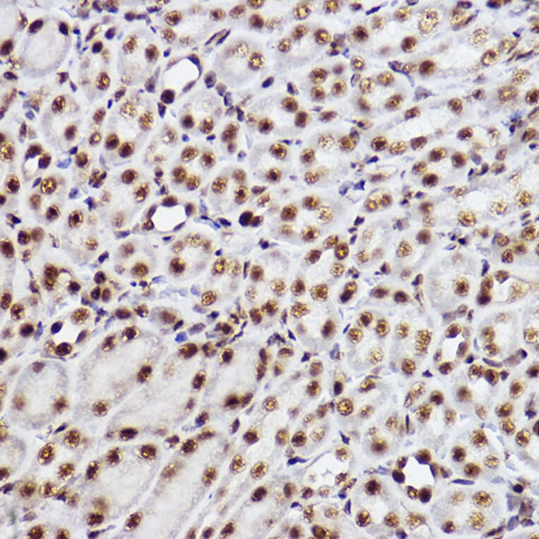 Immunohistochemistry - Anti-GTF2F2 Antibody [ARC2513] (A306881) - Antibodies.com