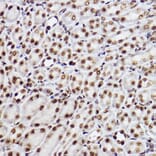 Immunohistochemistry - Anti-GTF2F2 Antibody [ARC2513] (A306881) - Antibodies.com