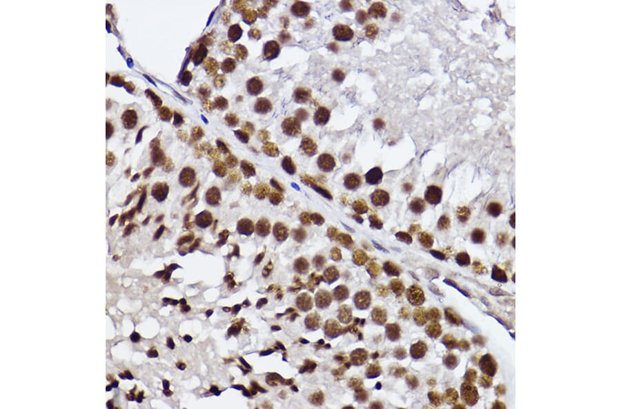 Immunohistochemistry - Anti-GTF2F2 Antibody [ARC2513] (A306881) - Antibodies.com