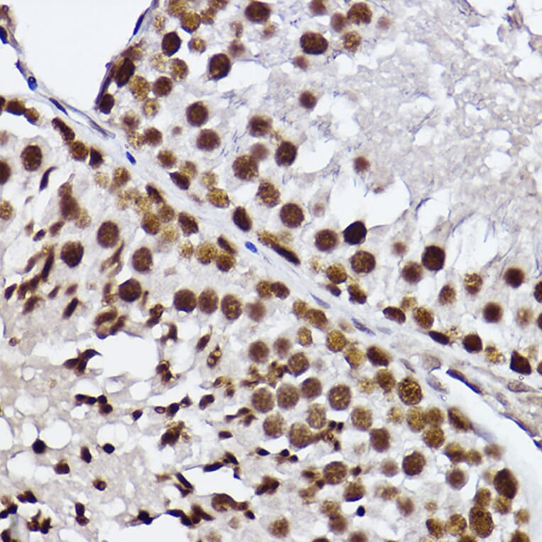 Immunohistochemistry - Anti-GTF2F2 Antibody [ARC2513] (A306881) - Antibodies.com