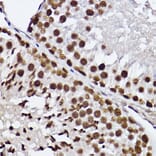 Immunohistochemistry - Anti-GTF2F2 Antibody [ARC2513] (A306881) - Antibodies.com