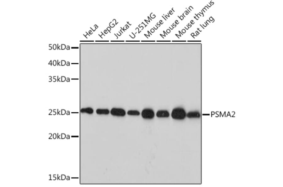 Western Blot - Anti-Proteasome 20S alpha 2/HC3 Antibody [ARC1465] (A306882) - Antibodies.com