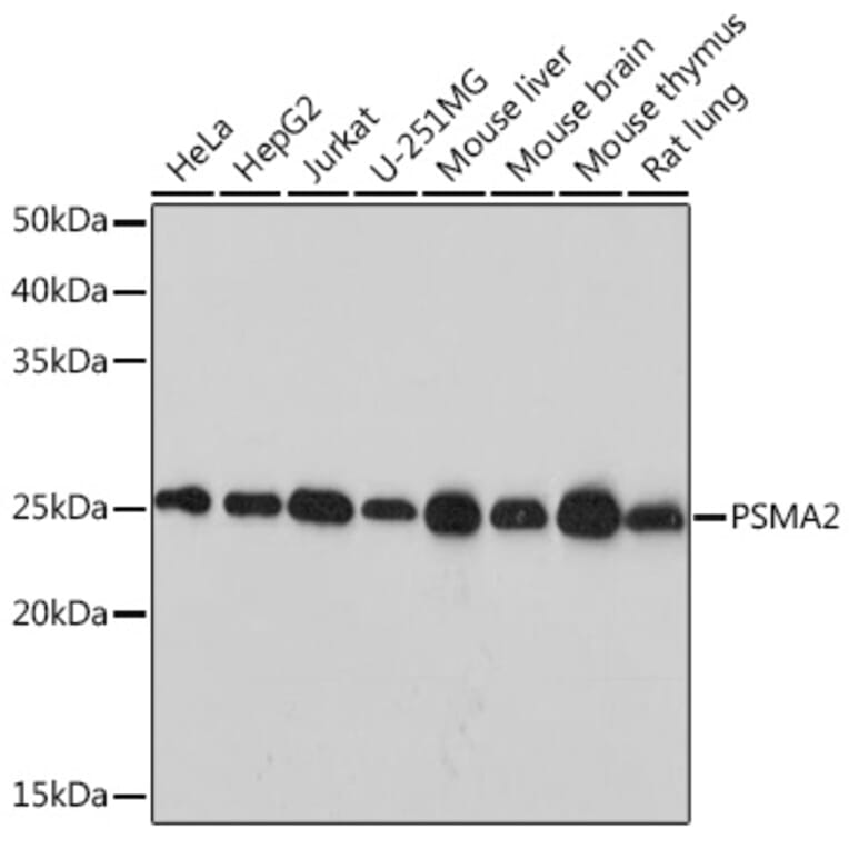 Western Blot - Anti-Proteasome 20S alpha 2/HC3 Antibody [ARC1465] (A306882) - Antibodies.com