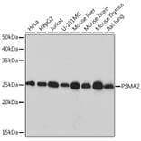 Western Blot - Anti-Proteasome 20S alpha 2/HC3 Antibody [ARC1465] (A306882) - Antibodies.com
