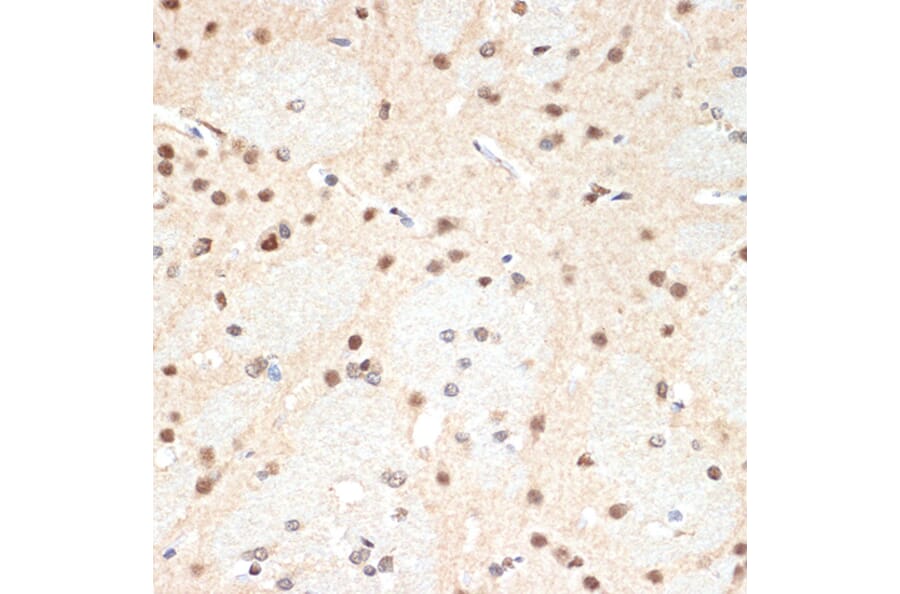 Immunohistochemistry - Anti-Proteasome 20S alpha 2/HC3 Antibody [ARC1465] (A306882) - Antibodies.com
