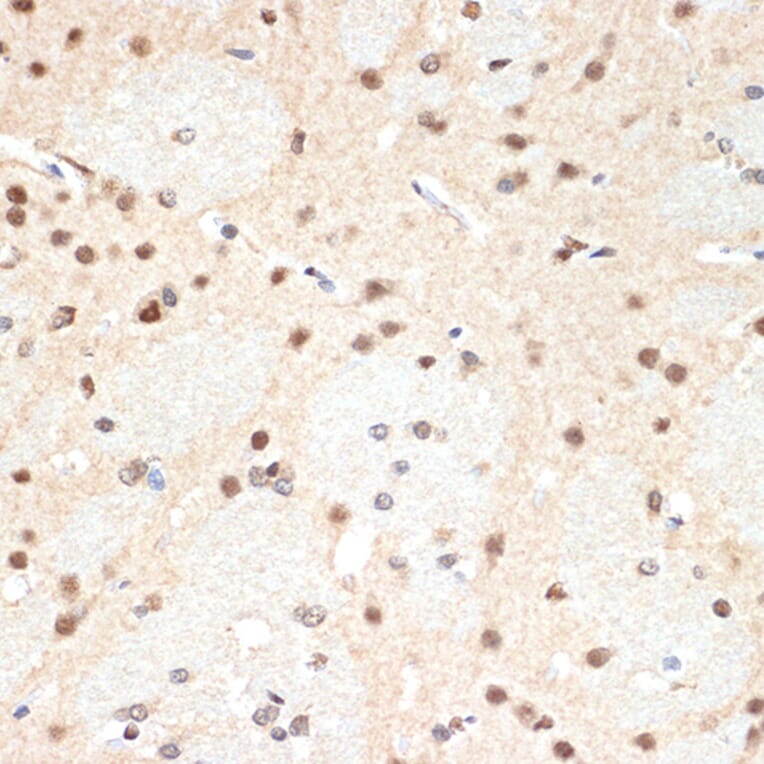 Immunohistochemistry - Anti-Proteasome 20S alpha 2/HC3 Antibody [ARC1465] (A306882) - Antibodies.com