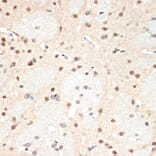 Immunohistochemistry - Anti-Proteasome 20S alpha 2/HC3 Antibody [ARC1465] (A306882) - Antibodies.com
