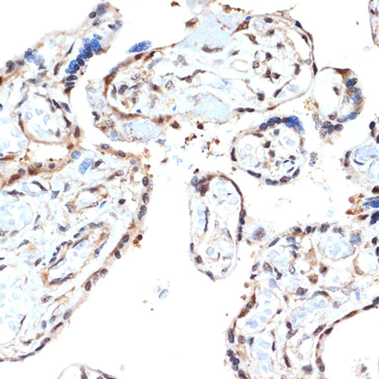 Immunohistochemistry - Anti-Proteasome 20S alpha 2/HC3 Antibody [ARC1465] (A306882) - Antibodies.com