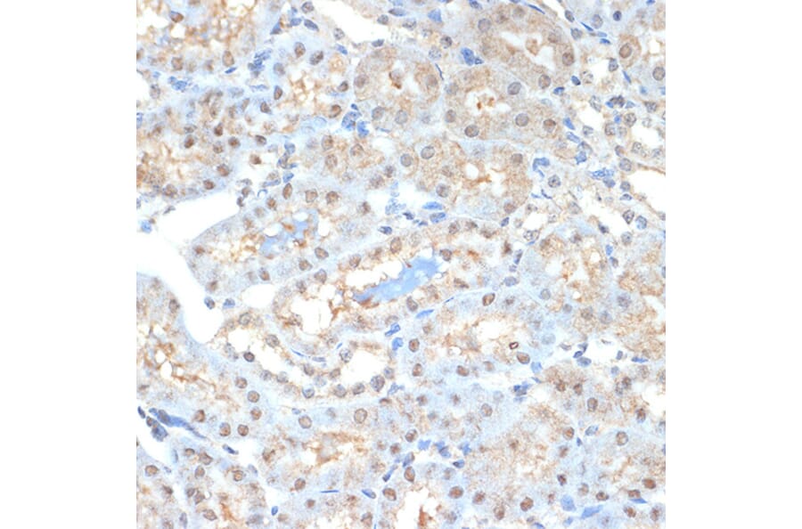 Immunohistochemistry - Anti-Proteasome 20S alpha 2/HC3 Antibody [ARC1465] (A306882) - Antibodies.com