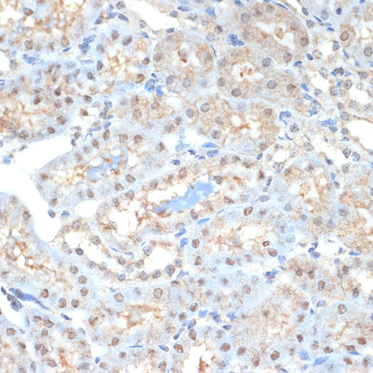 Immunohistochemistry - Anti-Proteasome 20S alpha 2/HC3 Antibody [ARC1465] (A306882) - Antibodies.com