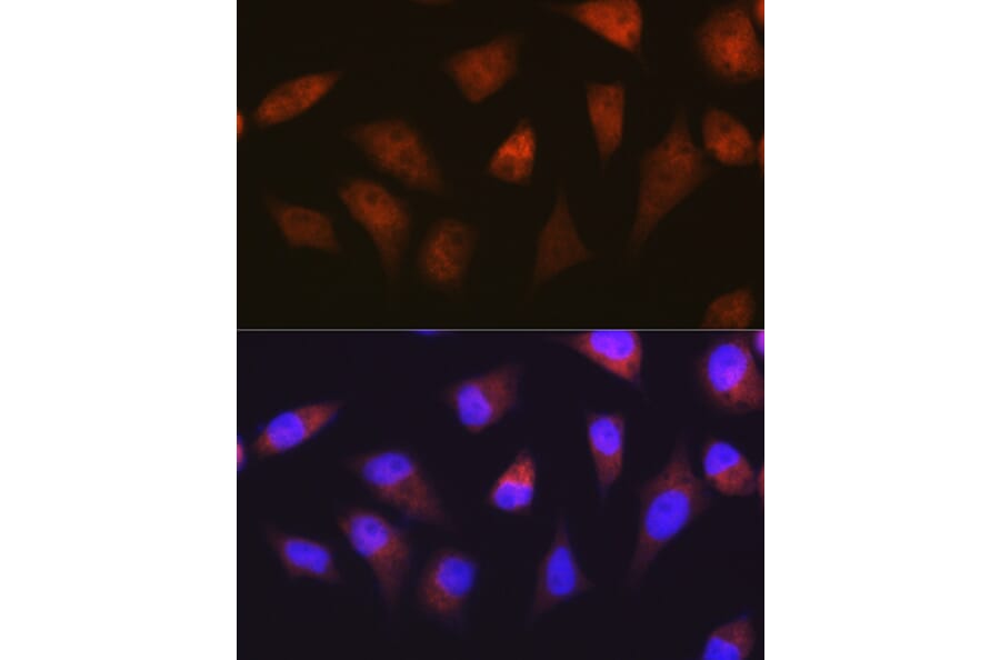 Immunofluorescence - Anti-Proteasome 20S alpha 2/HC3 Antibody [ARC1465] (A306882) - Antibodies.com