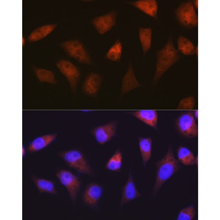 Immunofluorescence - Anti-Proteasome 20S alpha 2/HC3 Antibody [ARC1465] (A306882) - Antibodies.com