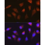 Immunofluorescence - Anti-Proteasome 20S alpha 2/HC3 Antibody [ARC1465] (A306882) - Antibodies.com