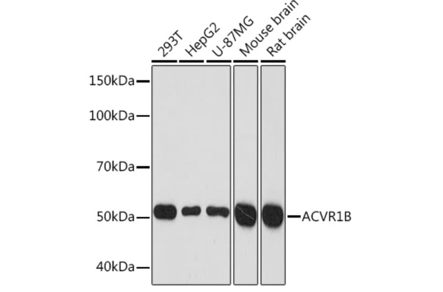 Western Blot - Anti-Activin A Receptor Type IB/ALK-4 Antibody [ARC1899] (A306883) - Antibodies.com