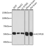 Western Blot - Anti-Activin A Receptor Type IB/ALK-4 Antibody [ARC1899] (A306883) - Antibodies.com