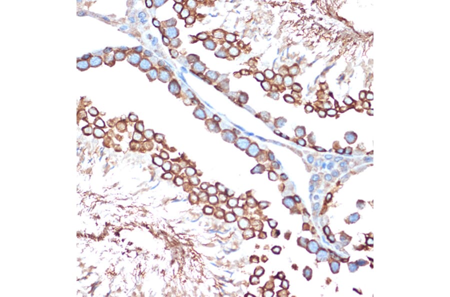 Immunohistochemistry - Anti-Activin A Receptor Type IB/ALK-4 Antibody [ARC1899] (A306883) - Antibodies.com