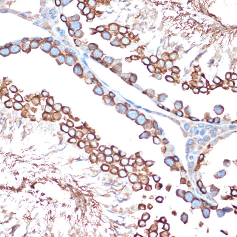 Immunohistochemistry - Anti-Activin A Receptor Type IB/ALK-4 Antibody [ARC1899] (A306883) - Antibodies.com