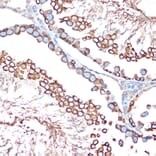 Immunohistochemistry - Anti-Activin A Receptor Type IB/ALK-4 Antibody [ARC1899] (A306883) - Antibodies.com