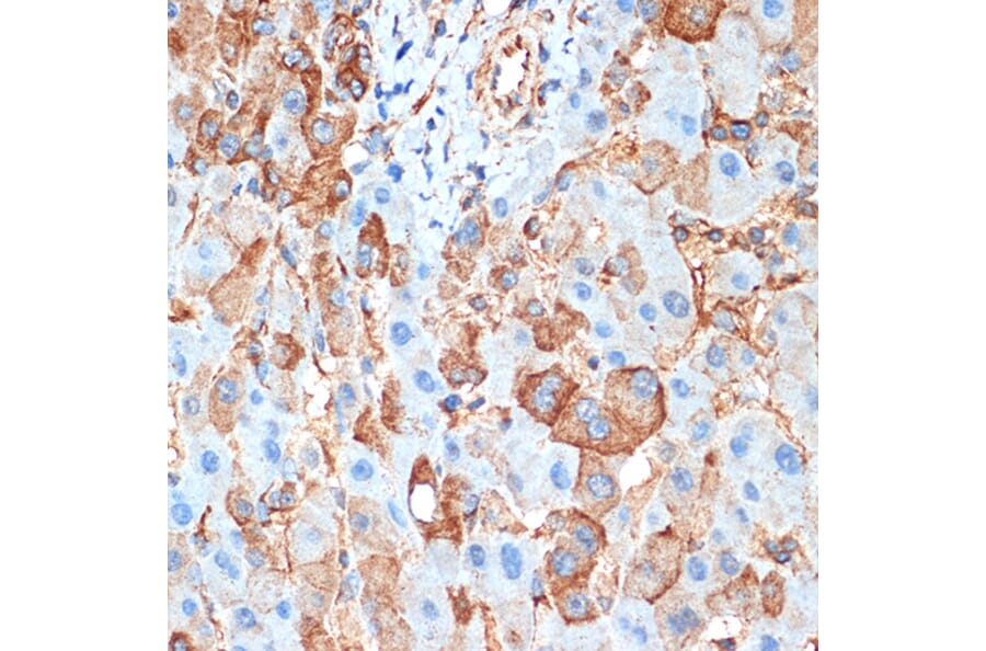 Immunohistochemistry - Anti-Activin A Receptor Type IB/ALK-4 Antibody [ARC1899] (A306883) - Antibodies.com