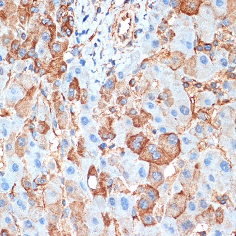 Immunohistochemistry - Anti-Activin A Receptor Type IB/ALK-4 Antibody [ARC1899] (A306883) - Antibodies.com