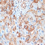 Immunohistochemistry - Anti-Activin A Receptor Type IB/ALK-4 Antibody [ARC1899] (A306883) - Antibodies.com