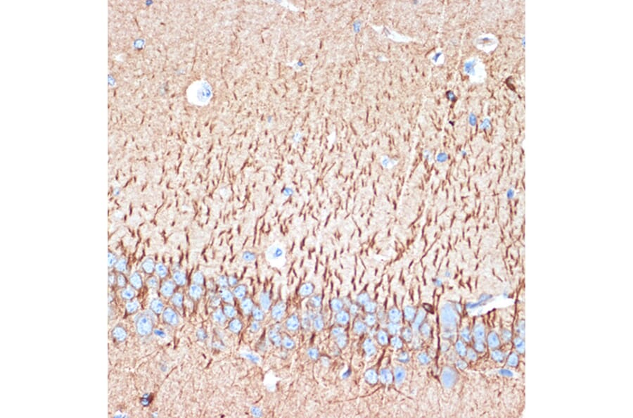 Immunohistochemistry - Anti-Activin A Receptor Type IB/ALK-4 Antibody [ARC1899] (A306883) - Antibodies.com