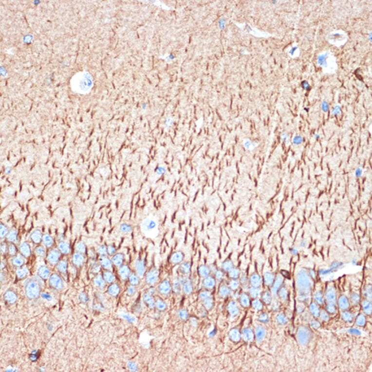 Immunohistochemistry - Anti-Activin A Receptor Type IB/ALK-4 Antibody [ARC1899] (A306883) - Antibodies.com