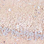 Immunohistochemistry - Anti-Activin A Receptor Type IB/ALK-4 Antibody [ARC1899] (A306883) - Antibodies.com