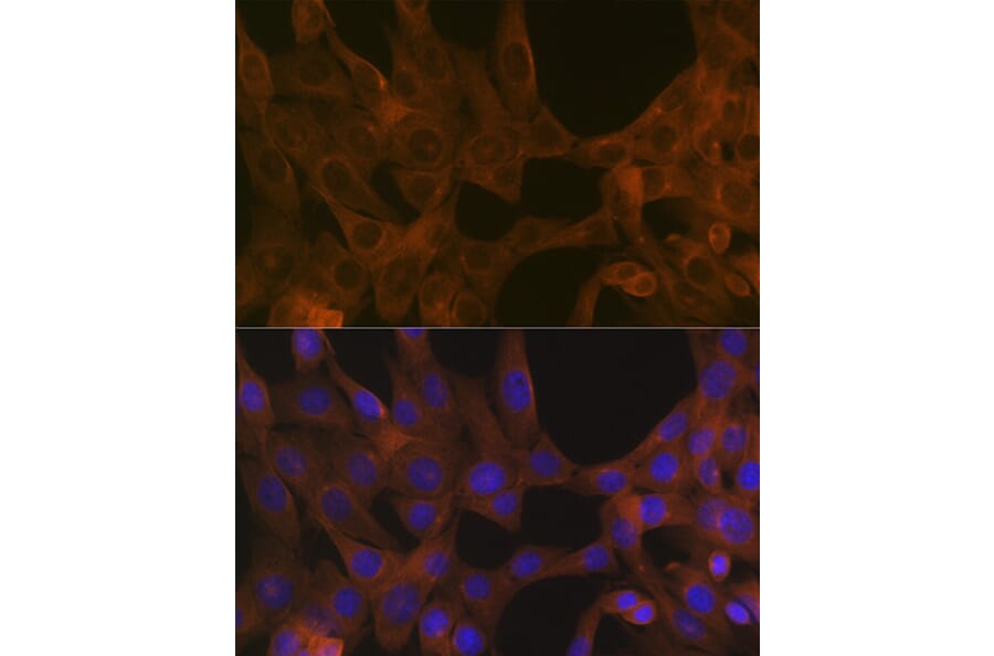 Immunofluorescence - Anti-Activin A Receptor Type IB/ALK-4 Antibody [ARC1899] (A306883) - Antibodies.com