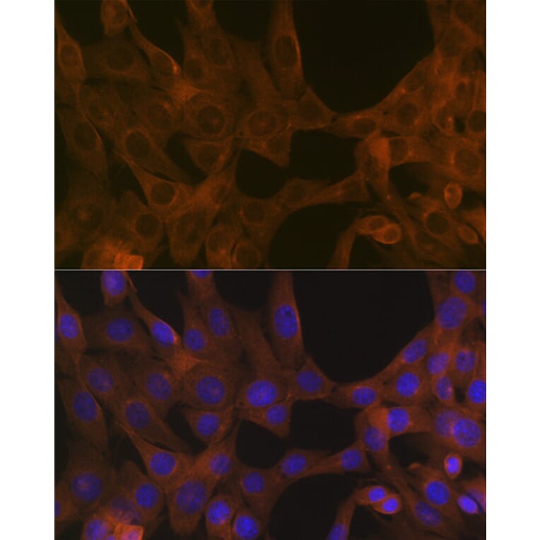 Immunofluorescence - Anti-Activin A Receptor Type IB/ALK-4 Antibody [ARC1899] (A306883) - Antibodies.com