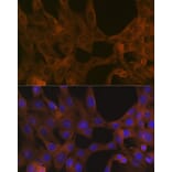 Immunofluorescence - Anti-Activin A Receptor Type IB/ALK-4 Antibody [ARC1899] (A306883) - Antibodies.com