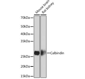Western Blot - Anti-Calbindin Antibody [ARC0953] (A306884) - Antibodies.com