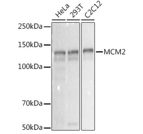 Western Blot - Anti-MCM2 Antibody [ARC2596] (A306885) - Antibodies.com