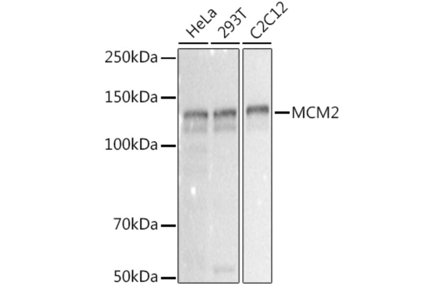 Western Blot - Anti-MCM2 Antibody [ARC2596] (A306885) - Antibodies.com