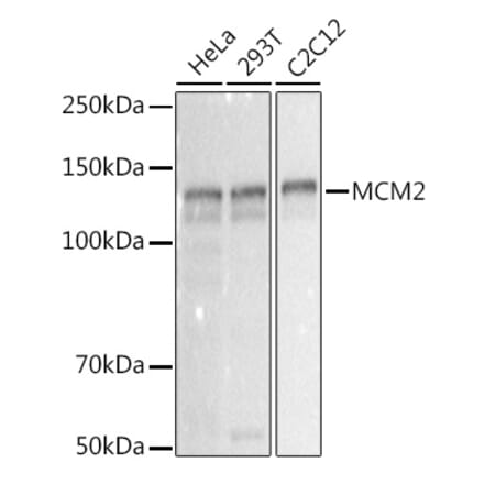 Western Blot - Anti-MCM2 Antibody [ARC2596] (A306885) - Antibodies.com