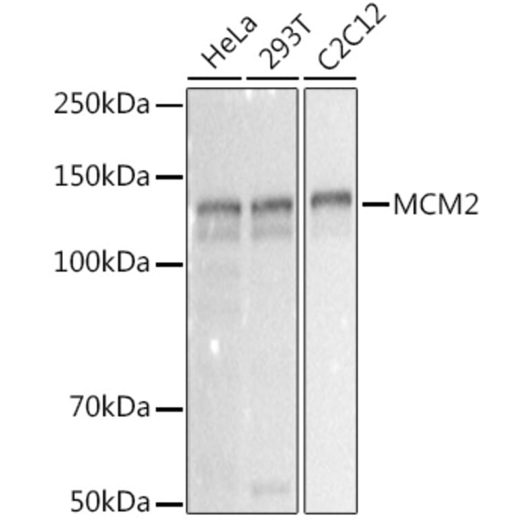 Western Blot - Anti-MCM2 Antibody [ARC2596] (A306885) - Antibodies.com
