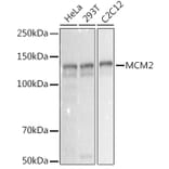 Western Blot - Anti-MCM2 Antibody [ARC2596] (A306885) - Antibodies.com