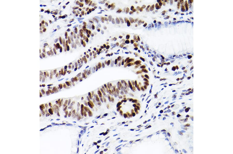 Immunohistochemistry - Anti-MCM2 Antibody [ARC2596] (A306885) - Antibodies.com