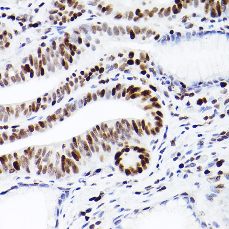 Immunohistochemistry - Anti-MCM2 Antibody [ARC2596] (A306885) - Antibodies.com